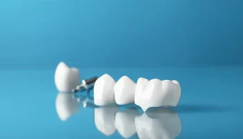 Can a Dental Crown Fall Off? Causes and Solution